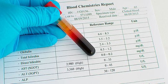 6 Gejala Liver yang Jarang Disadari, Kenali Agar Lebih Mudah untuk Mengobati