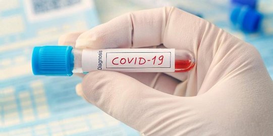 Polri: Hasil Swab PCR, Lurah Petamburan Terkonfirmasi Positif Covid-19