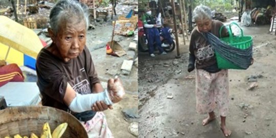 Kisah Nenek Penjual Pisang, Tak Mampu Obati Luka Hingga Busuk & Tinggal di Gubuk Reot