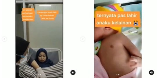 Kisah Wanita Saat Hamil Tak Pernah Minum Vitamin & USG, Begini Kondisi Bayinya