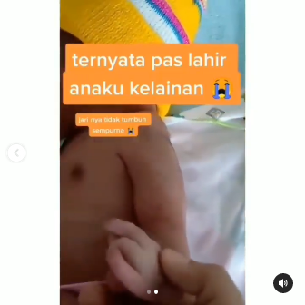 kisah wanita saat hamil tak pernah minum vitamin amp usg