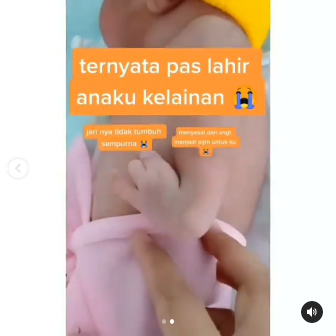 kisah wanita saat hamil tak pernah minum vitamin amp usg