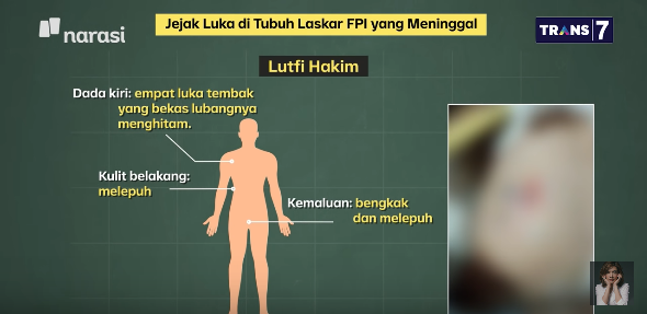 kondisi 6 jenazah fpi pengawal habib rizieq