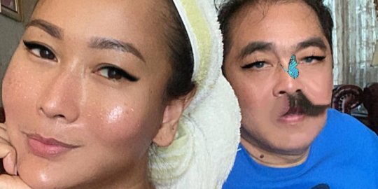 Putuskan Cukur Kumis, Penampilan Adam Suami Inul Daratista Ini Bikin Pangling