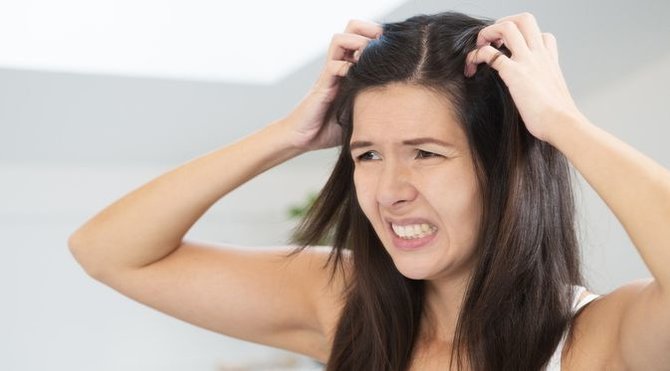 9 cara menghilangkan kutu rambut membandel