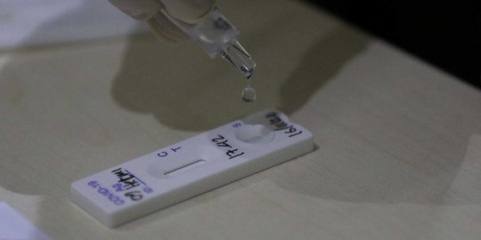 Polda Metro Selenggarakan Test Antigen Gratis, Ini Lokasinya