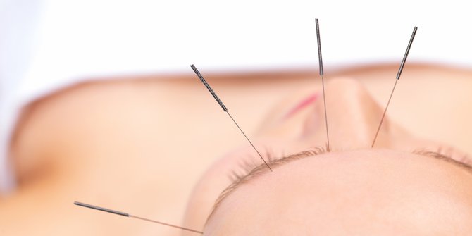 Akupunktur terdekat