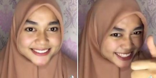 Wanita Cantik Beri Pesan Menohok & Bikin Salah Fokus, Ternyata Begini Kondisinya