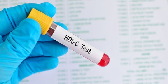 Cara Meningkatkan Kolesterol Baik (HDL) dalam Tubuh, Bantu Cegah Penyakit Jantung