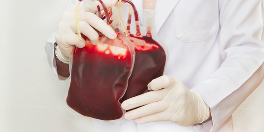 PMI Kota Bandung Terima Donor Plasma Darah, Begini Syarat-syaratnya