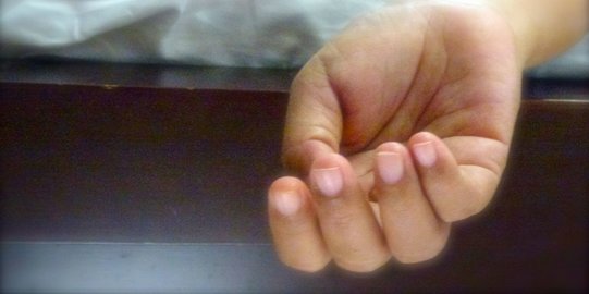 Diduga Usai Bunuh Anak Gadisnya, Seorang Pria di TTS Gantung Diri