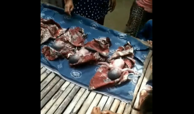 ibu melahirkan empat bayi di bangkalan