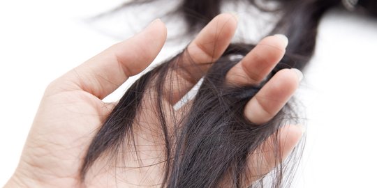 7 Cara Mengetahui Kerontokan Rambut yang Parah, Jangan Disepelekan