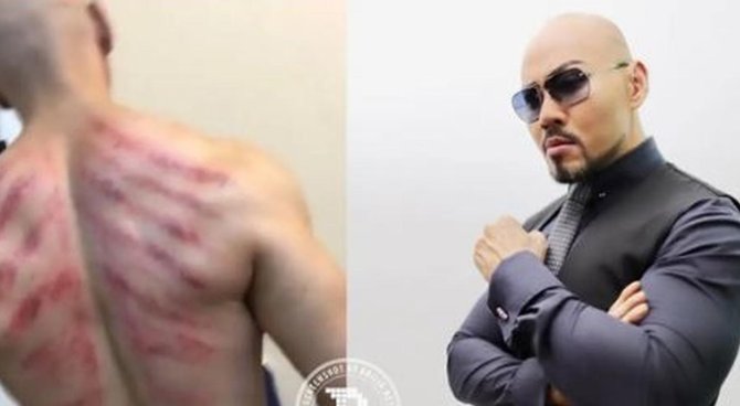 deretan artis ini masih suka kerokan jika tak enak badan