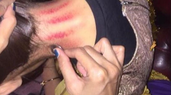 deretan artis ini masih suka kerokan jika tak enak badan