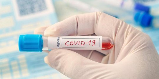 Sekda Kota Tarakan Positif Covid-19