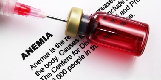 5 Suplemen Penambah Darah dengan Harga Murah, Cocok untuk Atasi Anemia