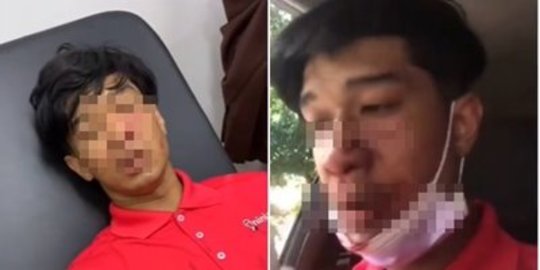 Viral Kurir Lagi Antar Barang Diserang Anjing Milik Customer, Wajahnya Luka Parah
