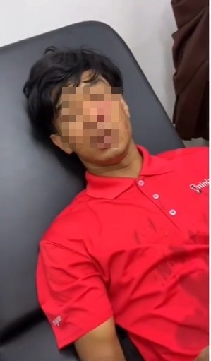 viral kurir lagi antar barang diserang anjing milik customer