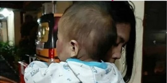 Bayi Dianiaya Sampai Babak Belur Seluruh Badan, Ini Tampang Pelakunya Pacar sang Ibu