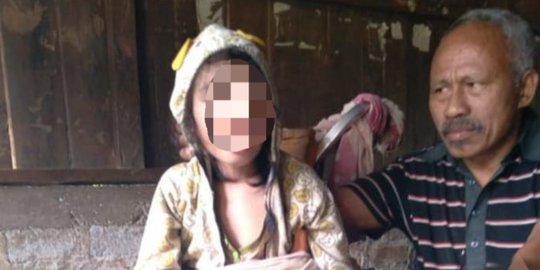 Kisah Pilu Bocah 9 Tahun Lumpuh Sejak Kecil, Orang Tua Tak Punya Biaya Berobat