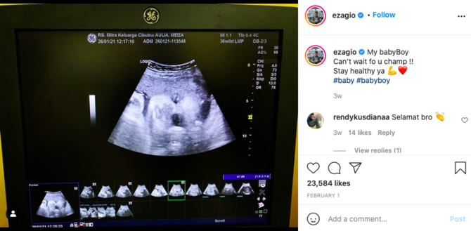 dikaruniai anak kedua intip momen perjalanan kehamilan meiza istri eza gionino