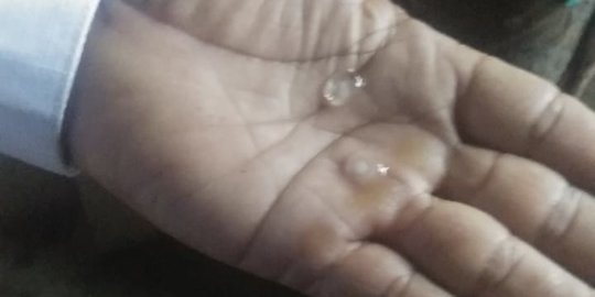 Hujan Es Sebesar Kelereng Bikin Kaget Warga Bangli Bali
