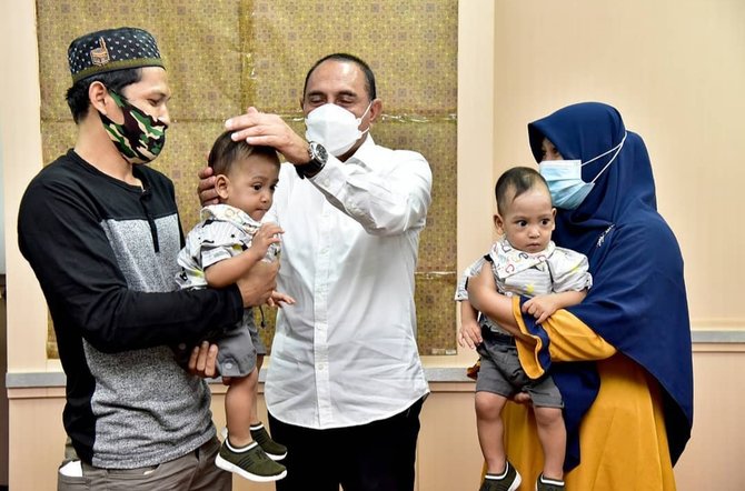 pulih usai operasi ini potret gubernur edy bersama bayi kembar siam adam haris