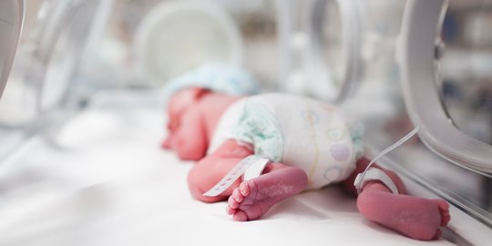 Kisah Pilu Bayi Tanpa Tempurung Kepala di Solo, Bertahan Hidup dengan Bantuan Oksigen