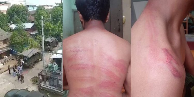 Tiga Jam dalam 'Ruang Neraka', Cerita Demontsran Myanmar Ditangkap & Disiksa Tentara | merdeka.com
