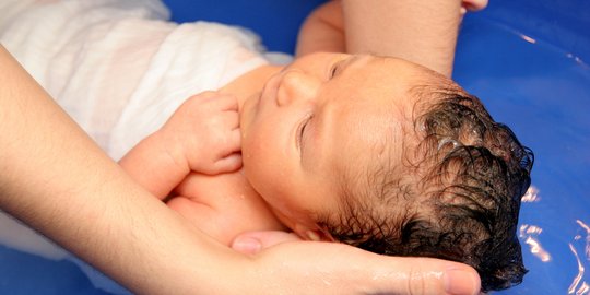 Kenali Penyebab Biang Keringat pada Bayi, Berikut Cara Menghilangkannya