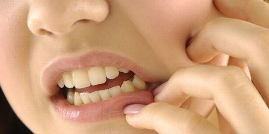 7 Makanan yang Bisa Berdampak Buruk bagi Kesehatan Gigi