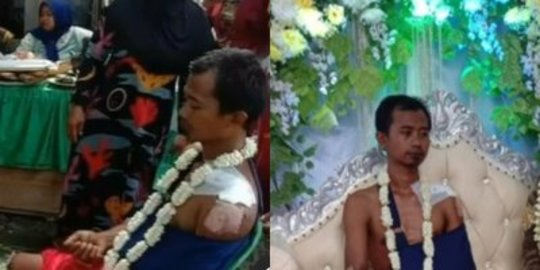 Viral Potret Pengantin Pria Tak Pakai Baju di Pelaminan, Badannya Penuh Perban