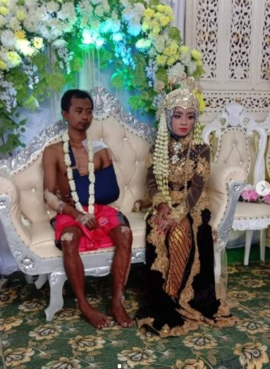 viral potret pengantin pria tak pakai baju di pelaminan badannya penuh perban