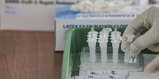 Dinkes DKI Khawatir Warga Terlena Hasil Negatif Rapid Test Antigen
