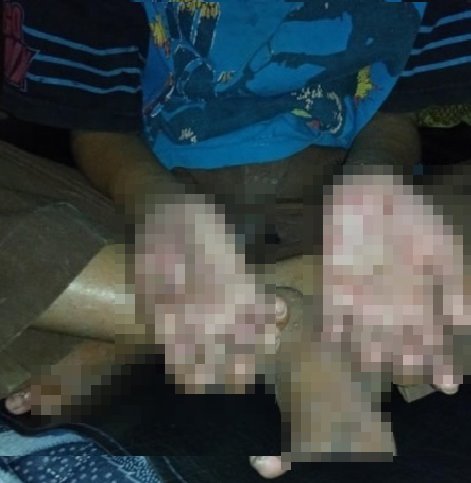 kisah miris wanita miliki tiga anak yang sakit kulit tak ada biaya amp jarang makan