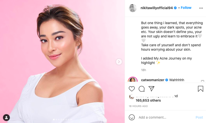 tak selalu mulus nikita willy beberkan pengalaman saat wajah penuh jerawat