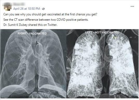 tidak benar foto ini hasil ct scan paru paru orang divaksin amp belum