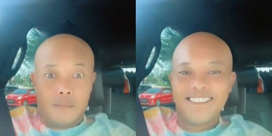 Jajal Filter di TikTok, Ini Penampilan 4 Seleb dengan Gaya Rambut Botak