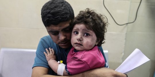 Ekspresi Anak-Anak Palestina yang Terluka dan Trauma Oleh Serangan Udara Israel