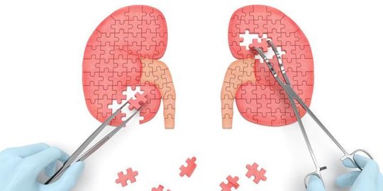 Kenali Fungsi Ureter Hingga Penyakit yang Dapat Menyerangnya, Perlu Dipahami