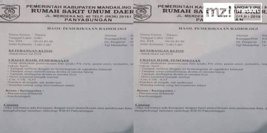 Heboh Hasil Radiologi Pasien Diduga Terpapar H2S, Ini Klarifikasi RSUD Panyabungan