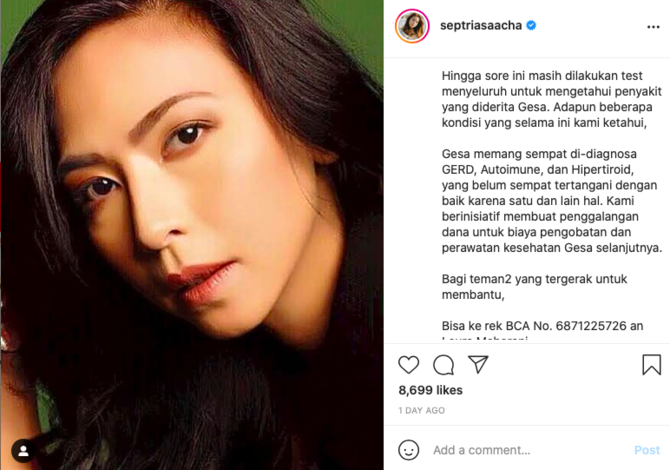 acha septriasa ungkap kondisi kesehatan gesata stella sempat sulit mengenali keluarga