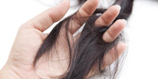 9 Kebiasaan Buruk Ini Sebabkan Rambut Rontok, Segera Hindari