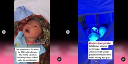 Sedih, ASI Tak Keluar & Bidan Larang Beri Sufor, Bayi Baru Lahir Ini Alami Bilirubin