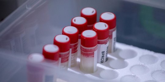 120 Pengendara di Suramadu Positif Covid-19 Usai Jalani Tes Swab PCR