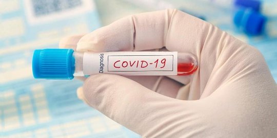 Pasien Covid-19 di Gunung Kidul Bertambah 86 Kasus Akibat Klaster