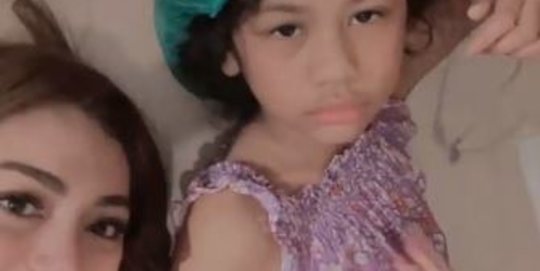 Alami Patah Tulang, Begini Kondisi Terkini Anak Celine Evangelista