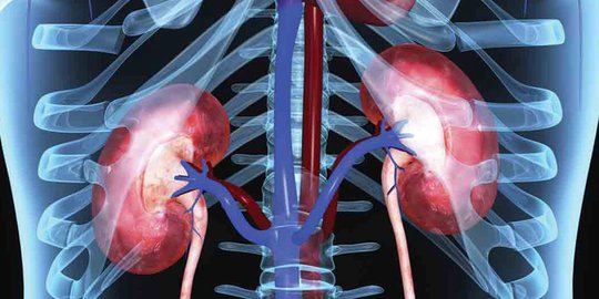 Penyebab Glomerulonefritis yang Perlu Diketahui, Kenali Gejala dan Cara Mengobatinya