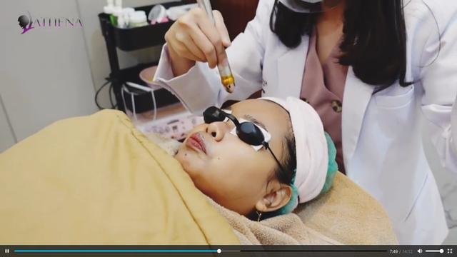 dari filler hidung hingga suntik tiruskan wajah ini 4 potret kekeyi jalani perawatan kecantikan